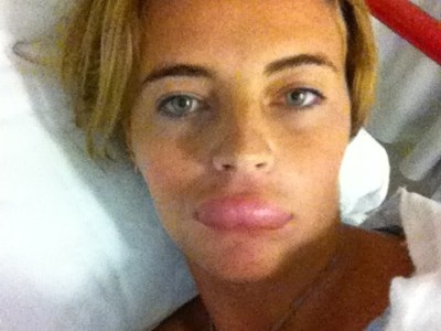 Here Is The Story Of ‘Bee’ing Stung In The&nbsp;Face